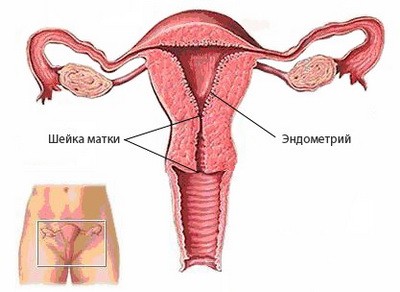 Почему болит левый или правый яичник5