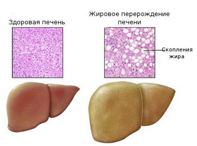 УЗИ печени и желчного пузыря5
