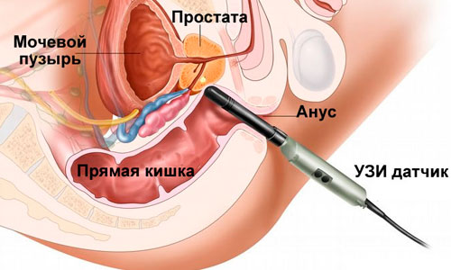 УЗИ половой системы5