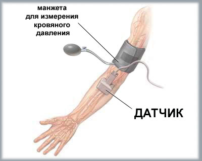 Допплерография5