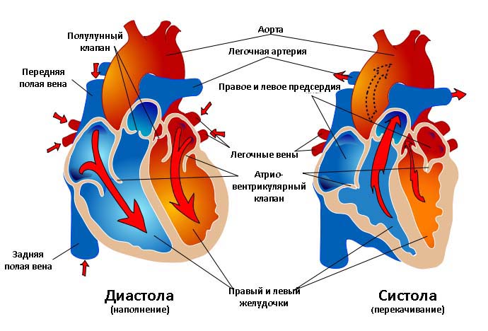 Вторичный дефект межпредсердной перегородки5