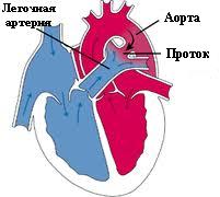 Анестезия новорожденных5
