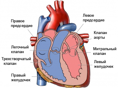 Лечение аномалии Эбштейна5