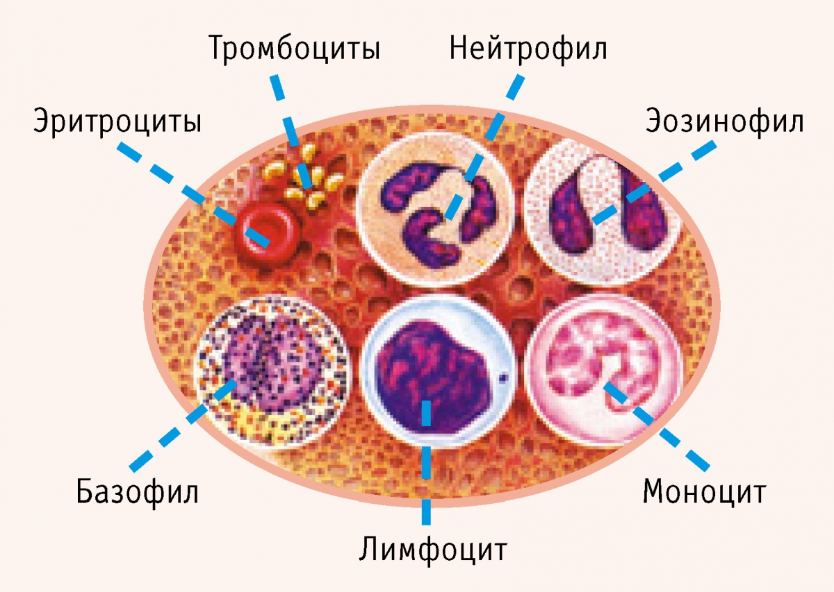 Осложнения сахарного диабета6