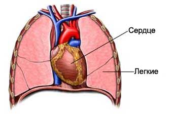 Осложнения искусственного кровообращения5
