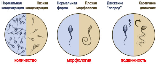 Нарушение морфологии спермограммы: причины5