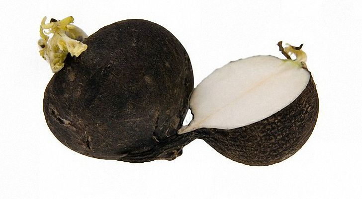 Люмбоишиалгия: острая, хроническая, симптомы, лечение5