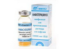 Гистоплазмоз: симптомы, лечение5