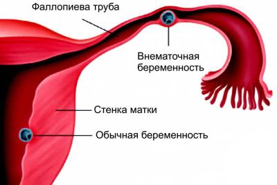 Почему болит в паху  у женщин5
