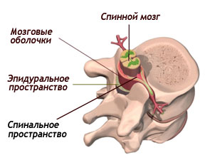 Литотрипсия в урологии. Методы литотрипсии5