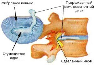 Травма центральной нервной системы5