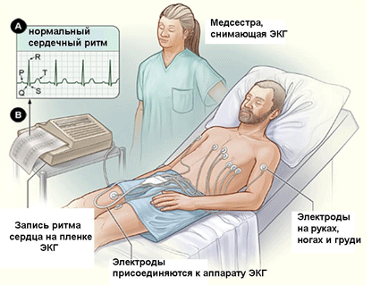 Порок клапана легочной артерии. Врожденный порок КЛА6