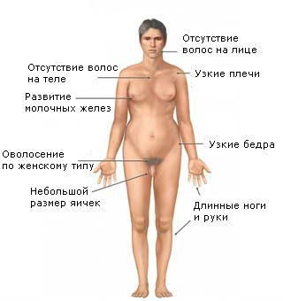 Патология интеллекта6