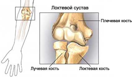 Перелом плечевой кости у ребенка6