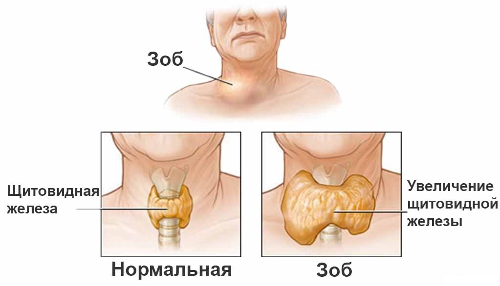Реакции гиперчувствительности: типы6