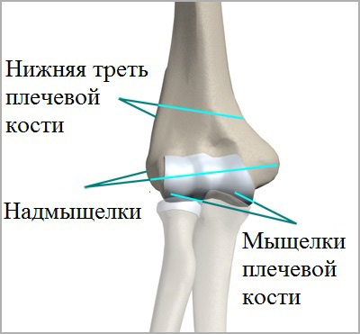 Переломы головки лучевой кости у детей6