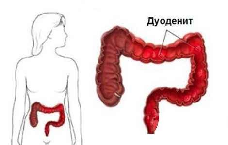 Почему болят бока под рёбрами6