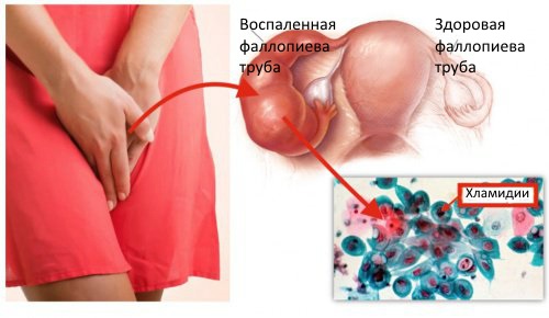 Почему после секса болят яичники6