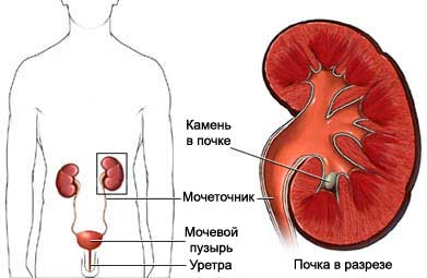 УЗИ почек, надпочечников, мочевого пузыря6