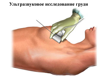УЗИ молочной железы6