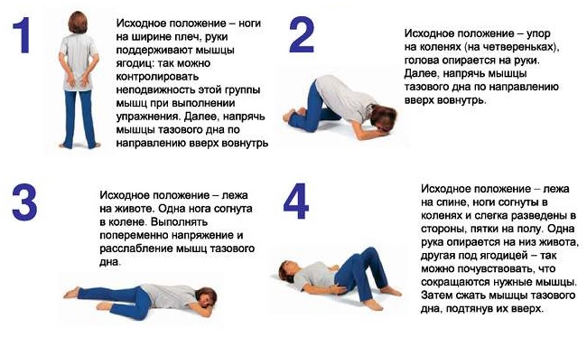 Недержание мочи у женщин: причины, симптомы, лечение6