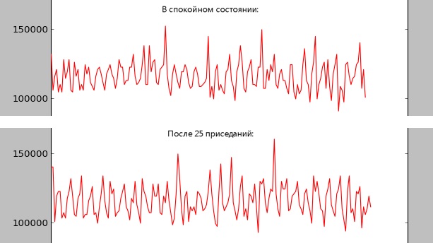 Учащенное сердцебиение: причины, симптомы, лечение6