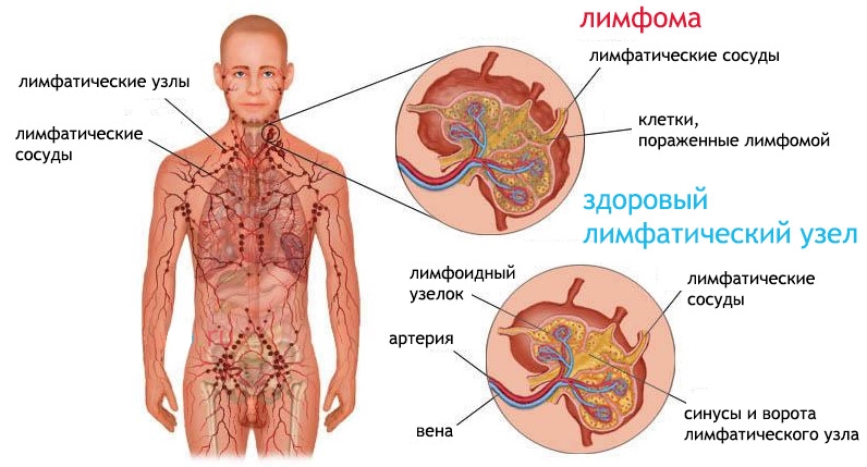 Иммунология опухолей7