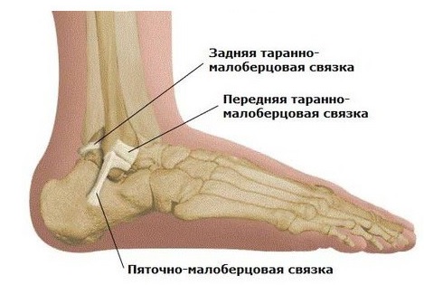 ДОА голеностопного сустава7