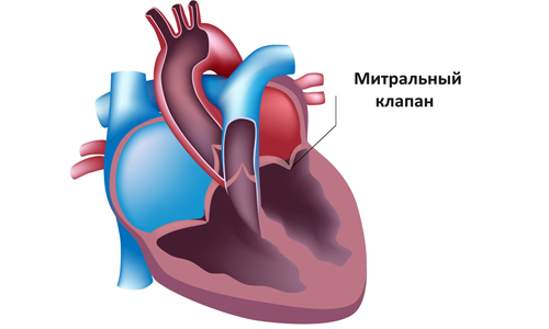 Вторичный дефект межпредсердной перегородки7