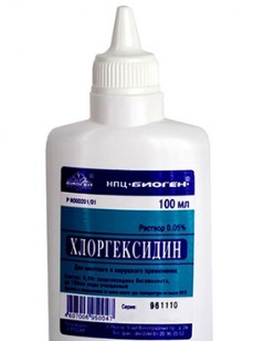 Осложнения после удаления зуба7
