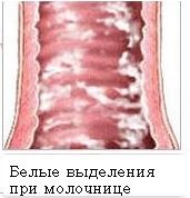 Выделения на ранних сроках беременности: причины, последствия7