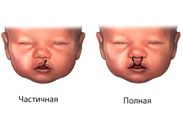 Патология интеллекта7