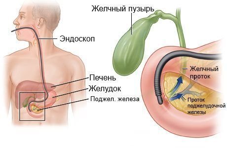 Механическая желтуха: причины, симптомы, лечение8