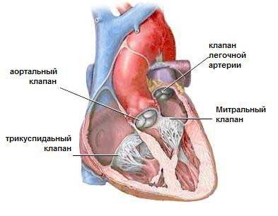 Морфология легочной гипертензии9