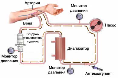 Анестезия в урологии9