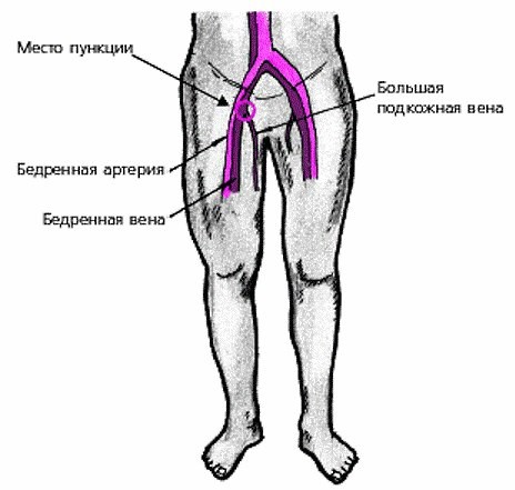 Неотложная реанимация9