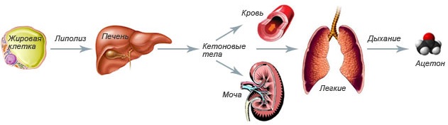Сахарный диабет 1 типа у детей: этиология, лечение, профилактика11