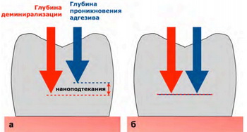 Химическое отбеливание зубов. Противопоказания к отбеливанию зубов11