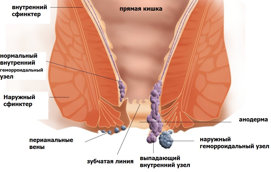 Боль в копчике: причины, лечение, боли при сидении, при вставании11