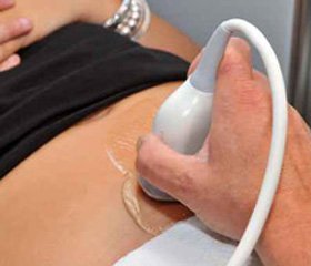 Аппендицит: признаки и симптомы, лечение, осложнения, фото, видео11