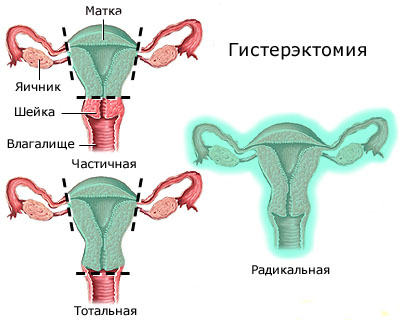 Поперечное положение плода: причины, операция12