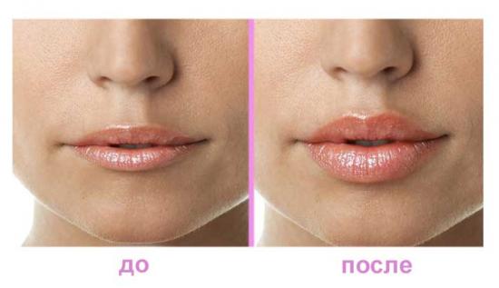 Что такое гиалуроновая кислота?12