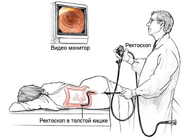 Цирроз печени: симптомы, лечение, стадии13