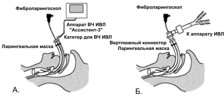 Шок: виды шока, помощь при шоке, последствия шока, фото13