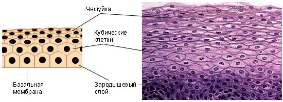 Хронический гонорейный уретрит14