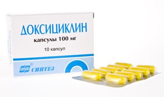 Выкидыш (самопроизвольный аборт): причины, сроки, угрозы16
