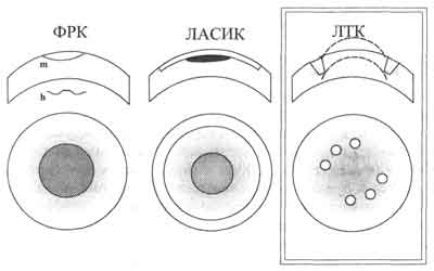 Электромагнитное, лазерное излучение, ультразвук16