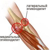 Болезни периферической нервной системы и опорно-двигательного аппарата, профессиональная дискинезия17