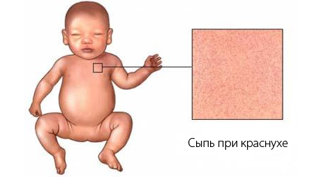 Инфекции при беременности. Оценка эффективности лечения19