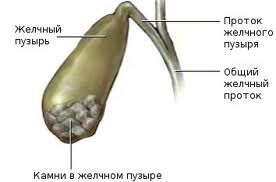 Заболевания желчного пузыря: симптомы, лечение1